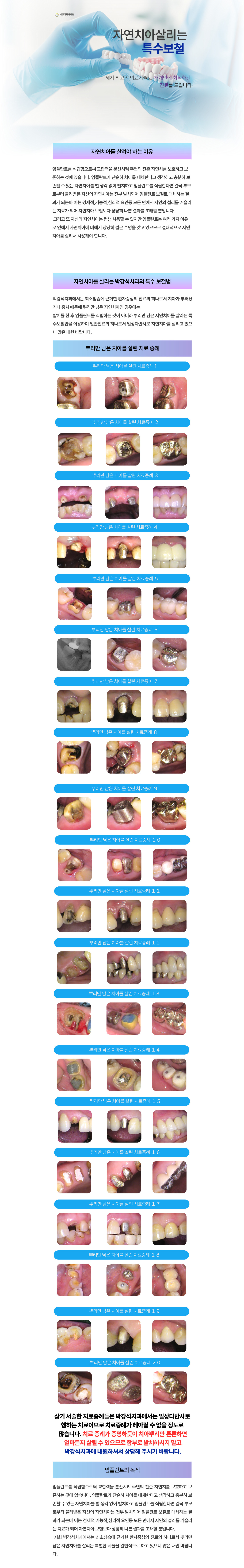 자연치아살리기